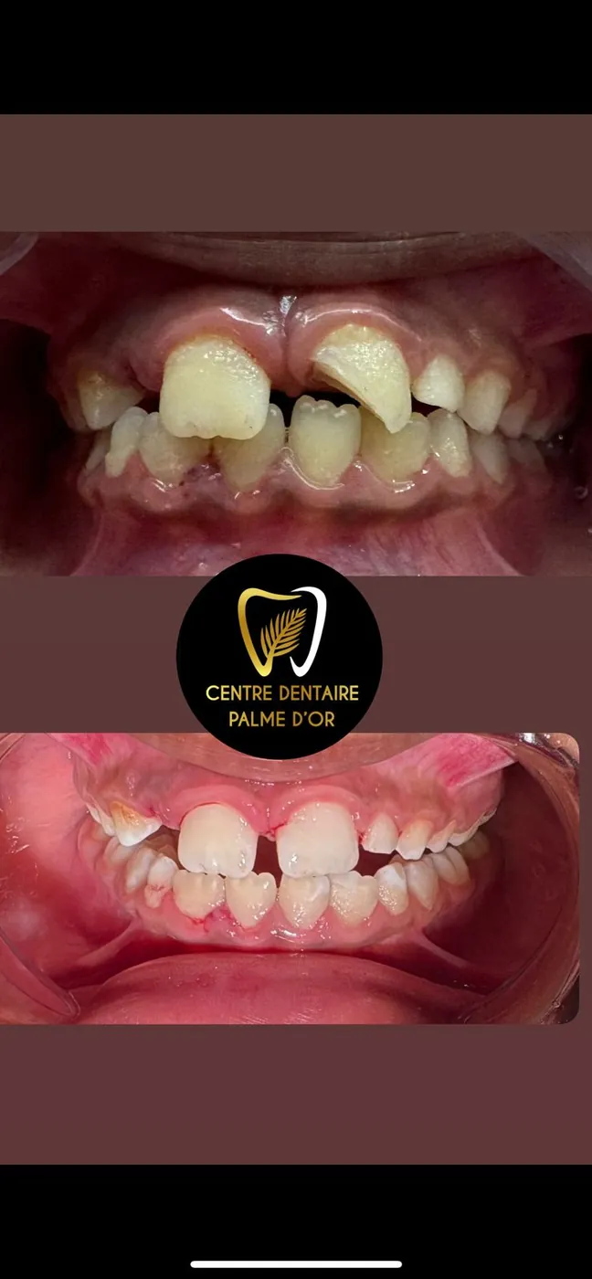 Cas 12