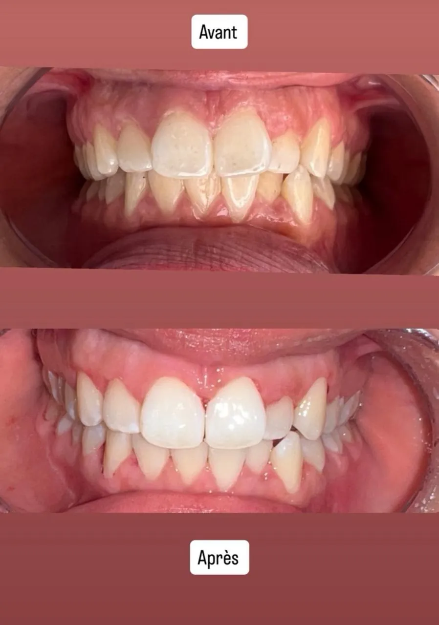 Cas 1