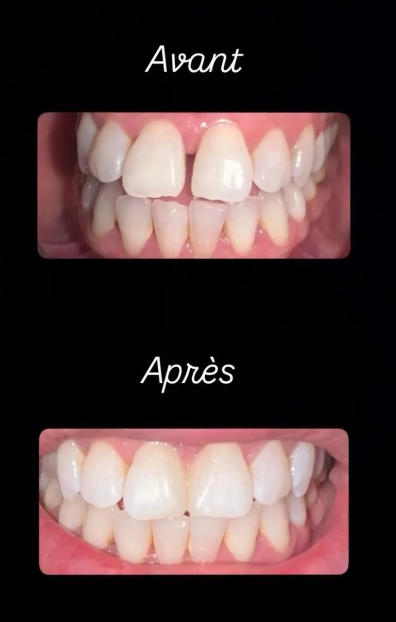 Cas 6
