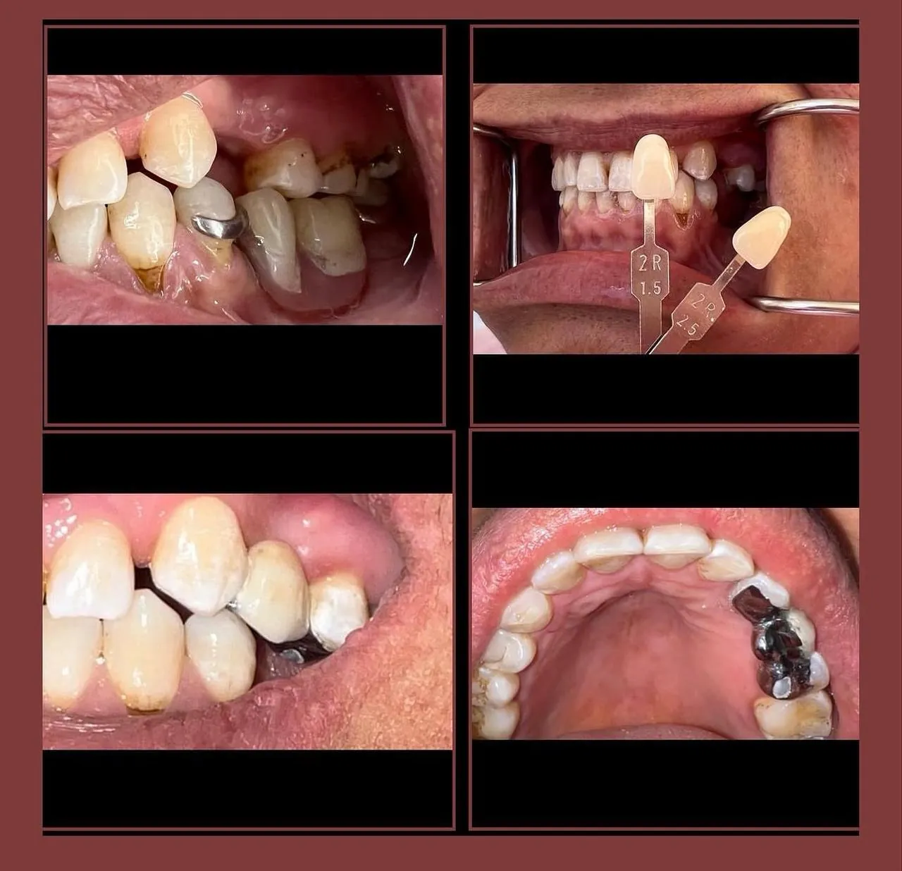 Cas 2