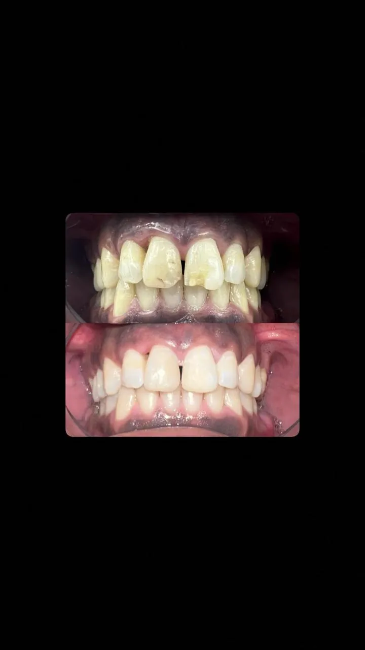 Cas 7