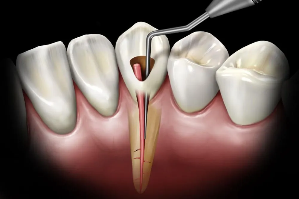 Endodontie