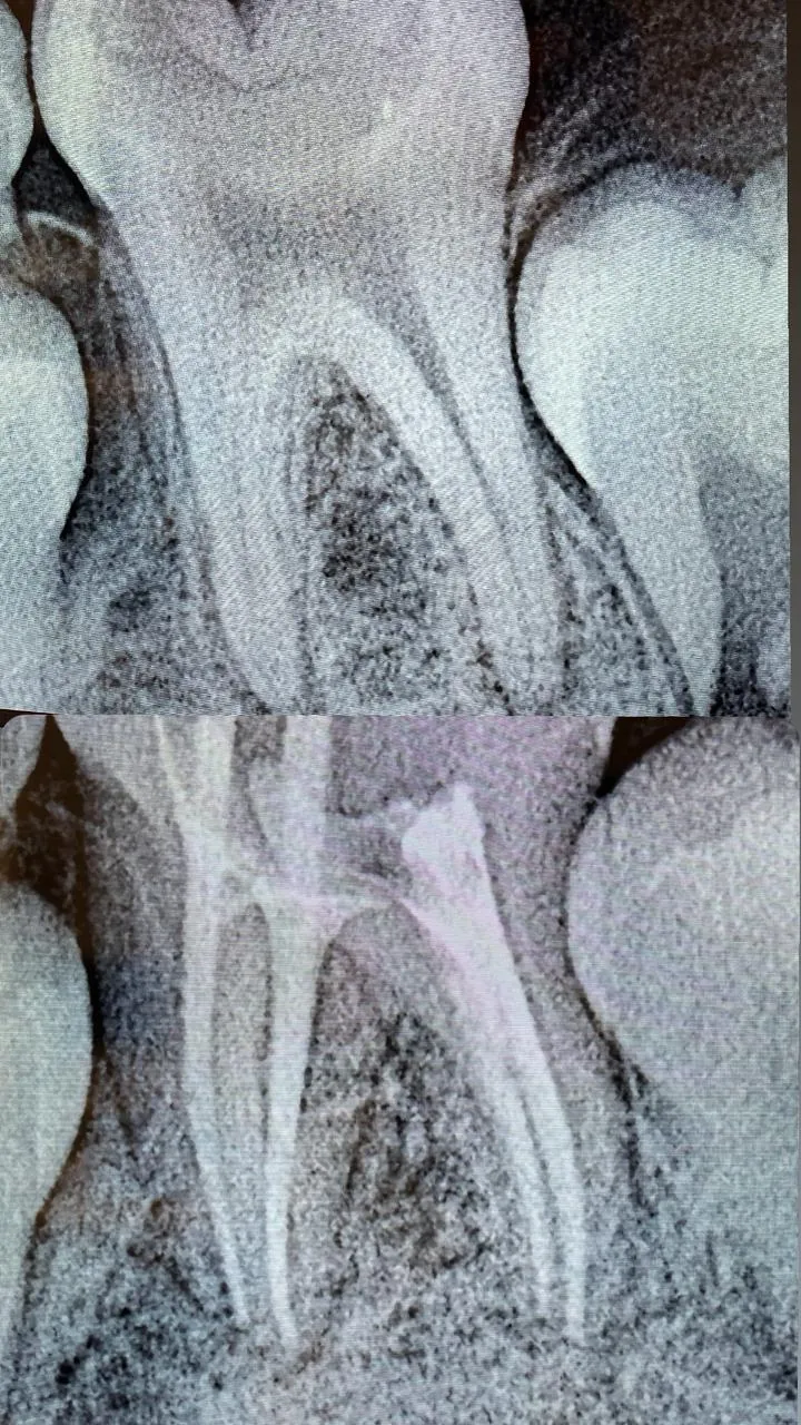 Cas 3